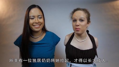 残疾女孩被父母抛弃，如今却变成大美女，称；